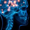 Can Stress Cause Long-Term Neurological Problems
