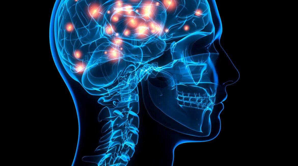 Can Stress Cause Long-Term Neurological Problems